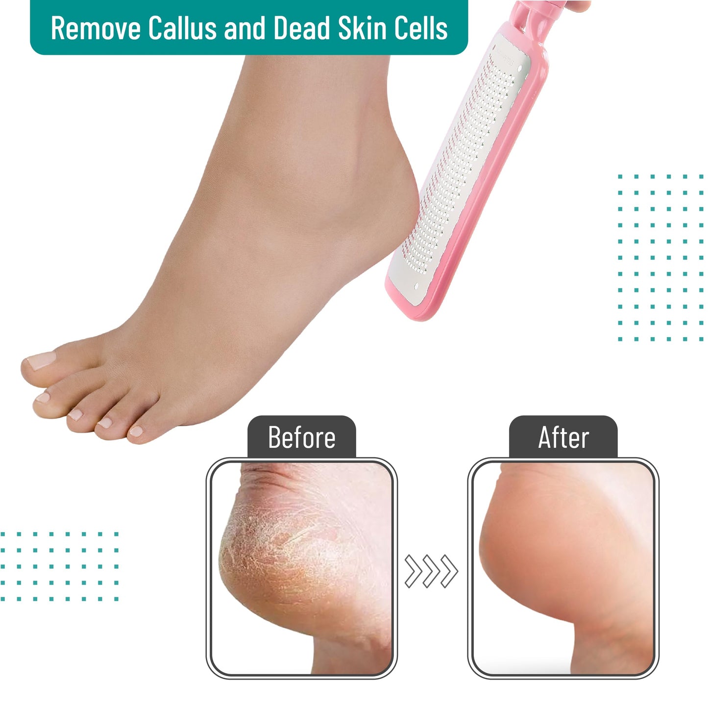 Slick- Foot File Callus Remover, Foot Scraper for Dead Skin, Foot Scrubber, Foot Rasp, Heel Scraper, Foot Grater for Dead Skin, Callus Remover for Feet, Foot File, Foot Callus Remover