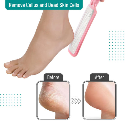 Slick- Foot File Callus Remover, Foot Scraper for Dead Skin, Foot Scrubber, Foot Rasp, Heel Scraper, Foot Grater for Dead Skin, Callus Remover for Feet, Foot File, Foot Callus Remover