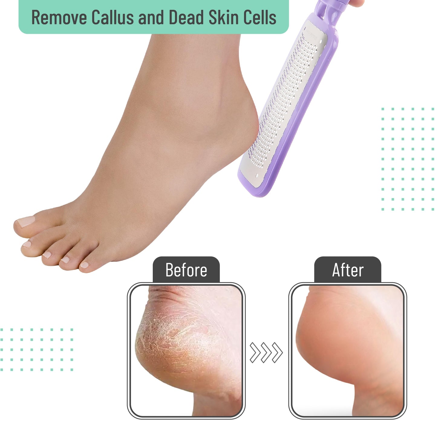 Slick- Foot File Callus Remover, Foot Scraper for Dead Skin, Foot Scrubber, Foot Rasp, Heel Scraper, Foot Grater for Dead Skin, Callus Remover for Feet, Foot File, Foot Callus Remover