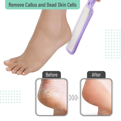Slick- Foot File Callus Remover, Foot Scraper for Dead Skin, Foot Scrubber, Foot Rasp, Heel Scraper, Foot Grater for Dead Skin, Callus Remover for Feet, Foot File, Foot Callus Remover