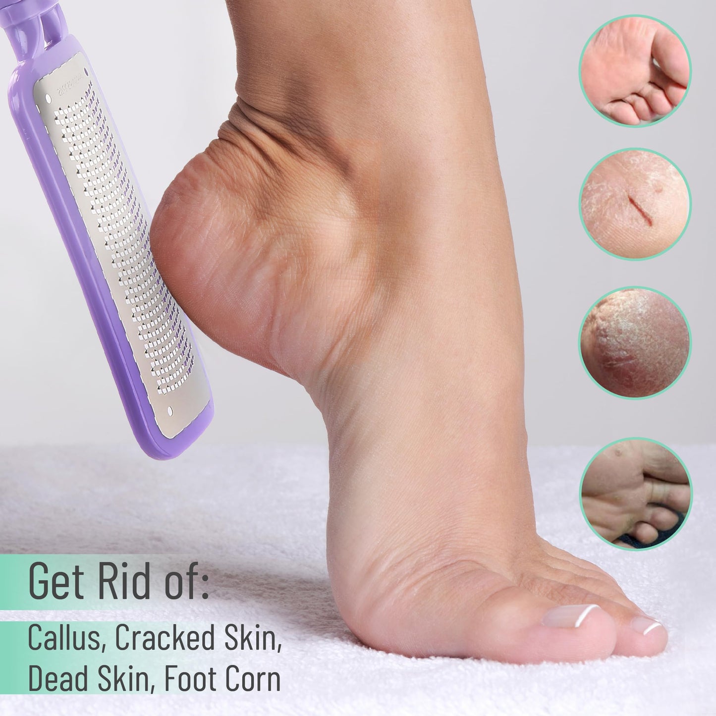 Slick- Foot File Callus Remover, Foot Scraper for Dead Skin, Foot Scrubber, Foot Rasp, Heel Scraper, Foot Grater for Dead Skin, Callus Remover for Feet, Foot File, Foot Callus Remover