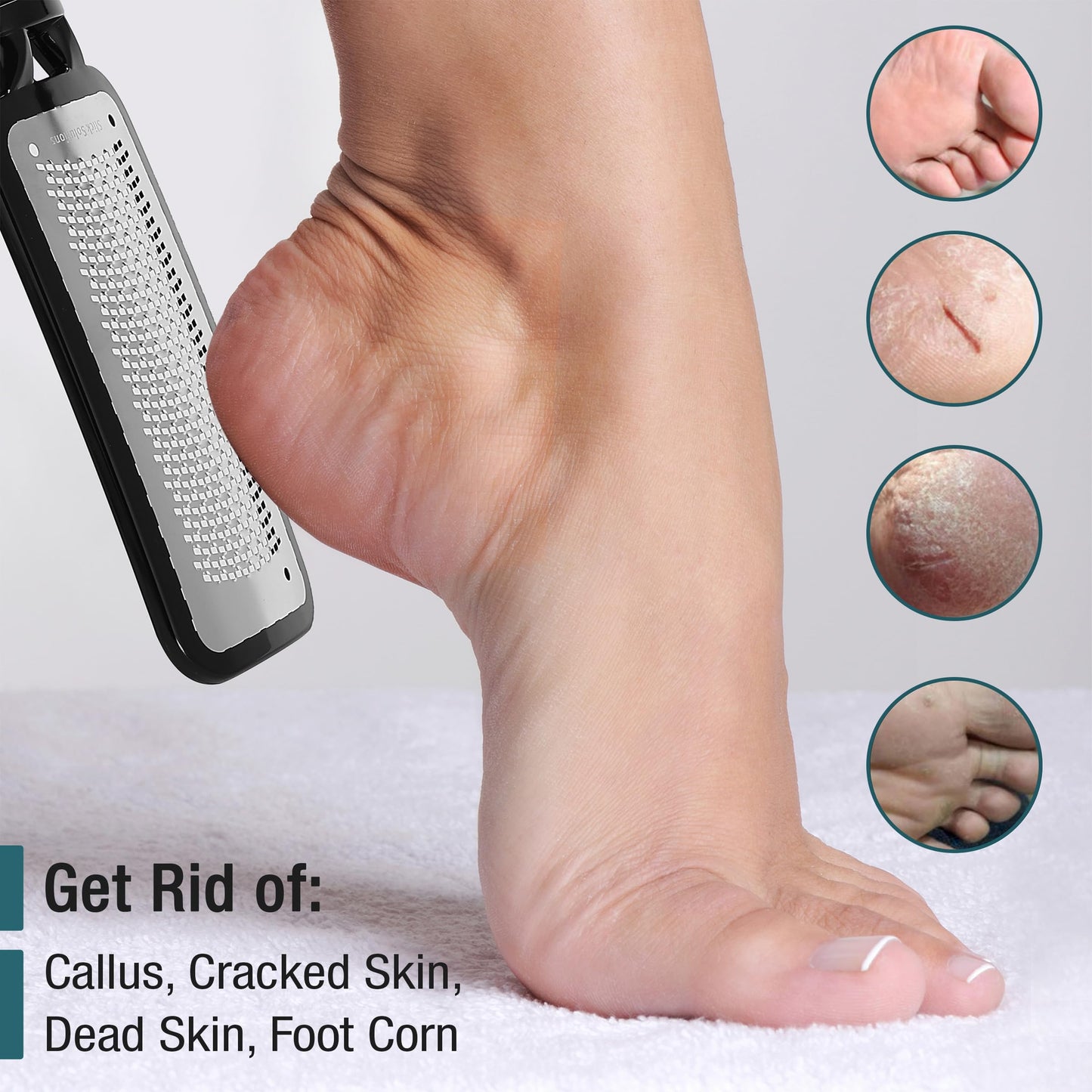 Slick- Foot File Callus Remover, Foot Scraper for Dead Skin, Foot Scrubber, Foot Rasp, Heel Scraper, Foot Grater for Dead Skin, Callus Remover for Feet, Foot File, Foot Callus Remover