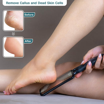 Slick- Foot File Callus Remover, Foot Scraper for Dead Skin, Foot Scrubber, Foot Rasp, Heel Scraper, Foot Grater for Dead Skin, Callus Remover for Feet, Foot File, Foot Callus Remover